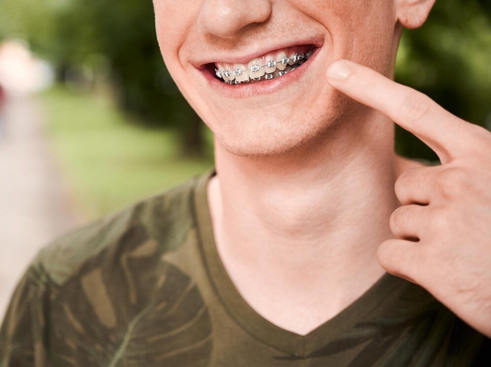 braces san antonio