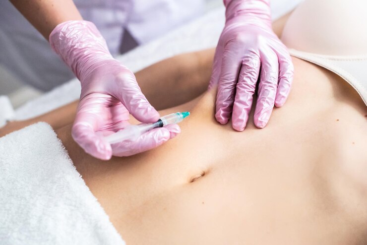 Fat Injections in Dubai