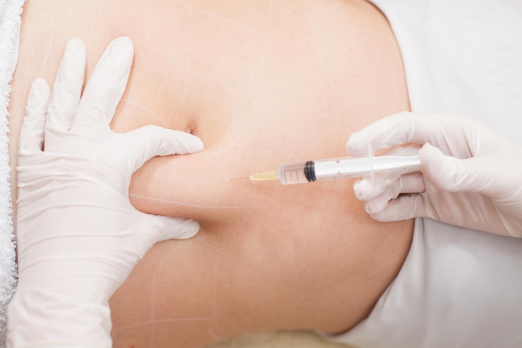 Fat Injections in Dubai