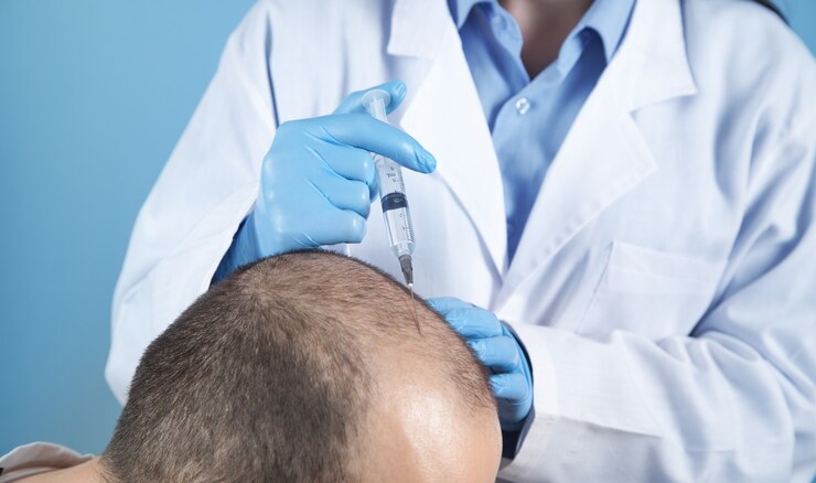 Hair Transplants in Ajman