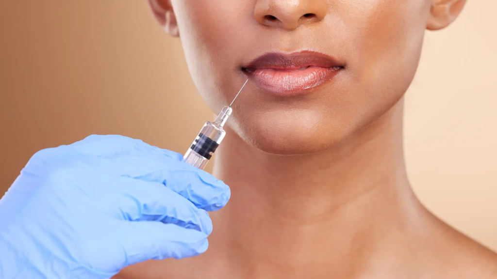 Lip Fillers Injections in Dubai
