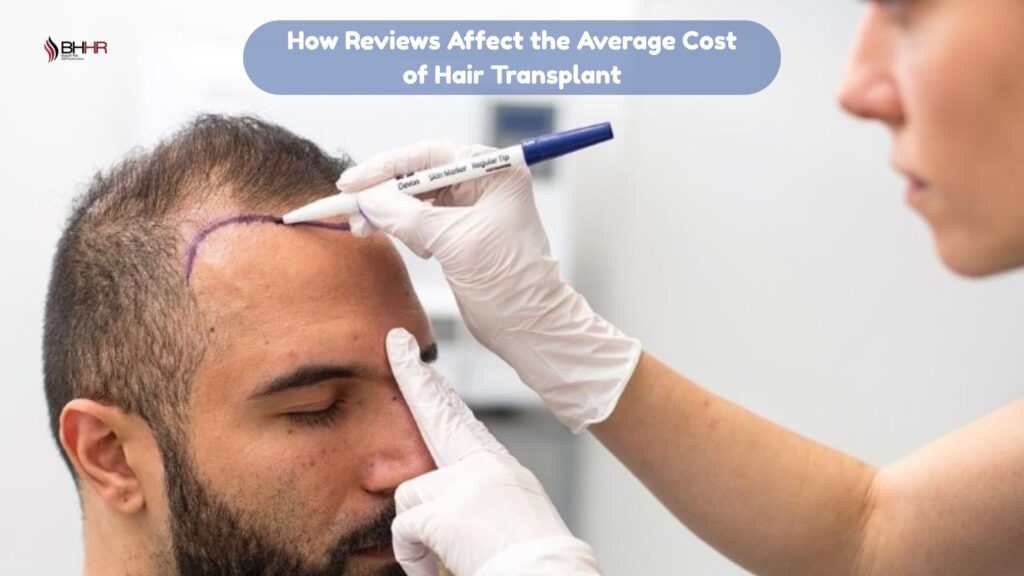average cost of hair transplant