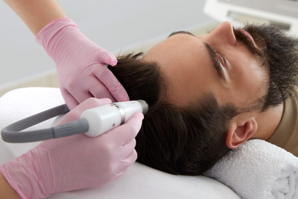 non surgical hair replacement in Dubai