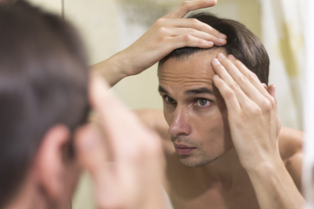 Non Surgical Hair Replacement in Dubai