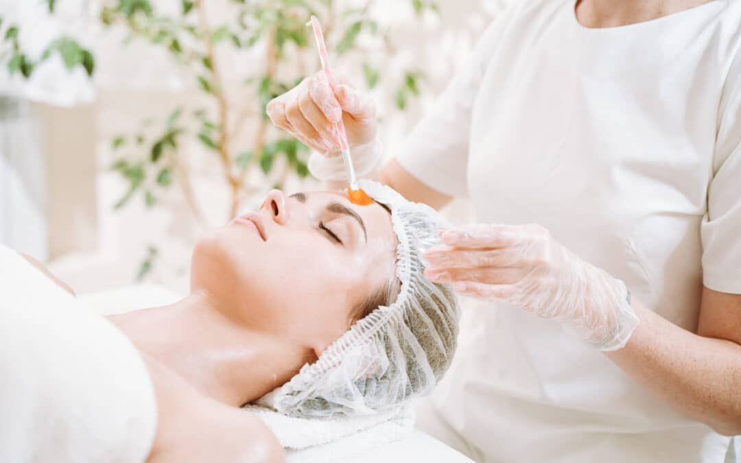 Chemical Peels in Dubai