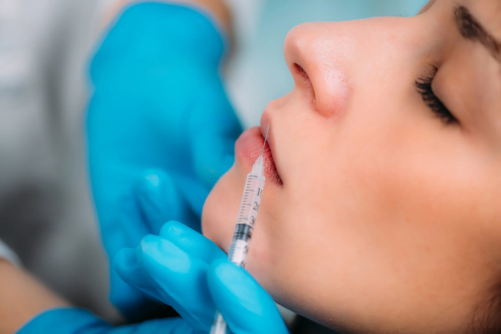 Volbella Fillers for Lips